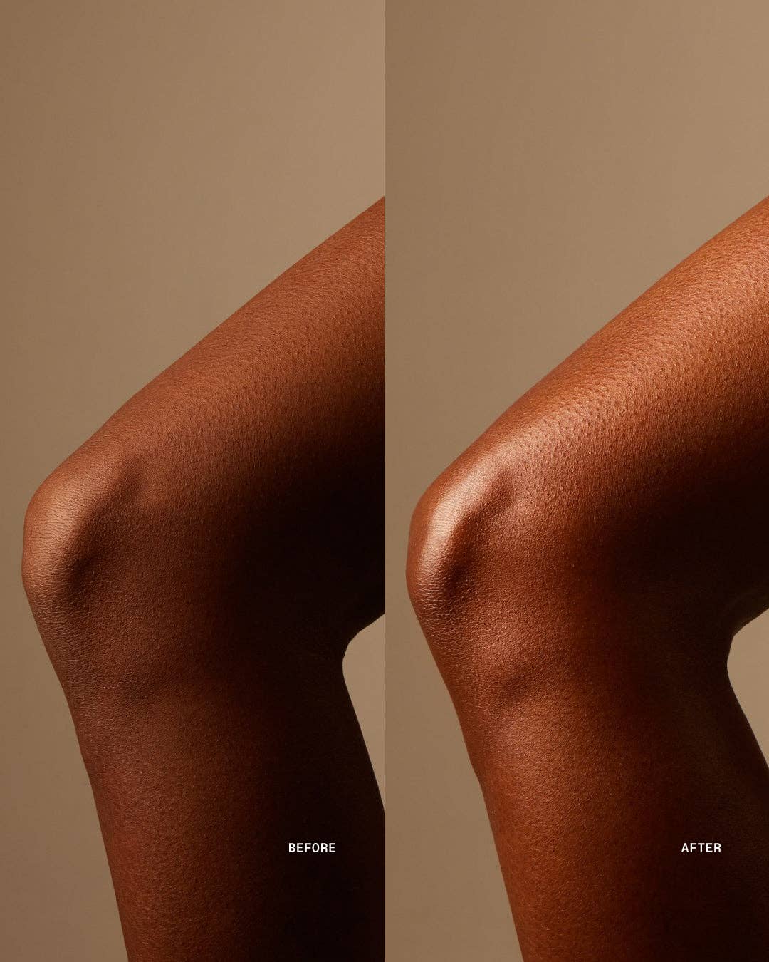 Body Serum