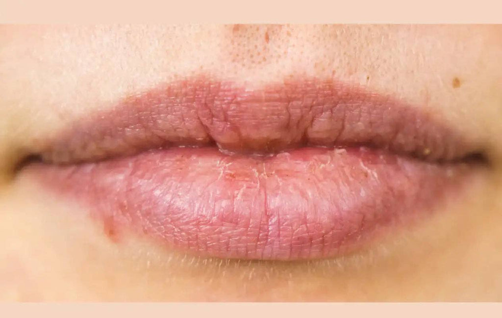 GLOW LIPS REJUVENATION