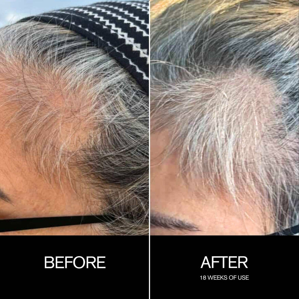 Copper Sequence - Leave-In Scalp Treatment