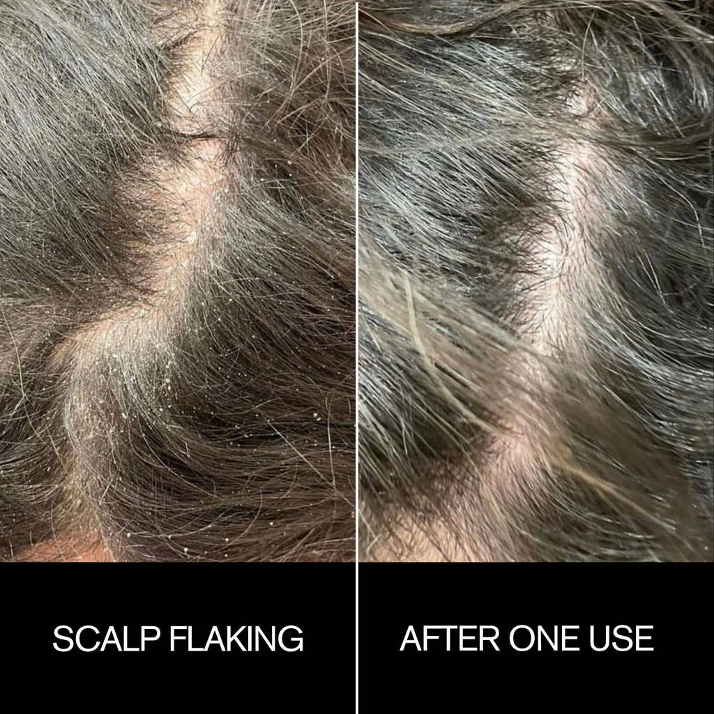 Sunday Scalp Mask
