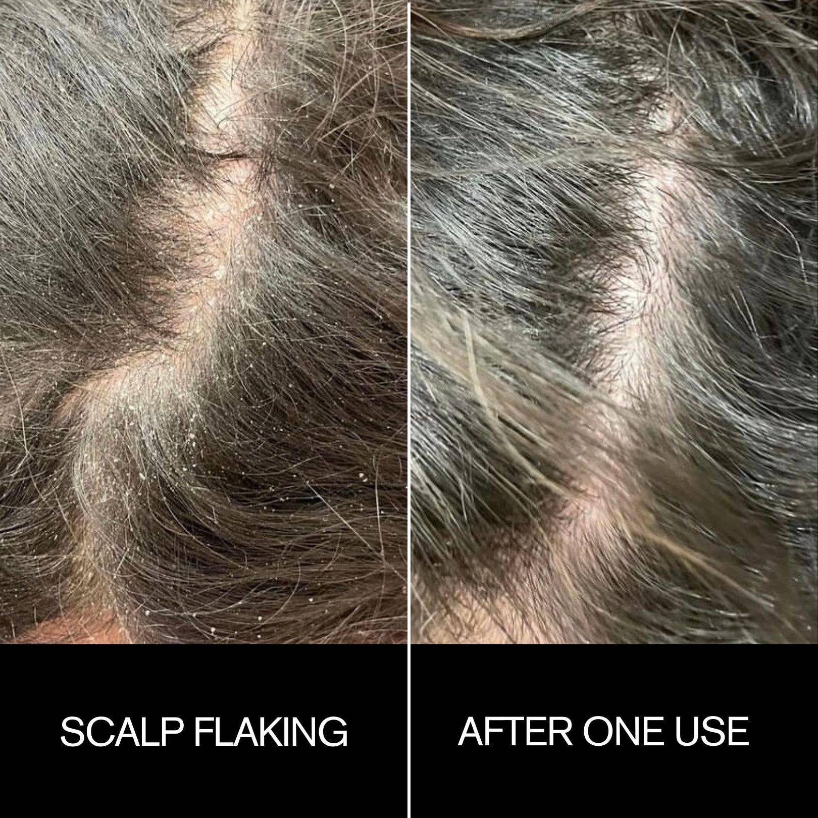 Sunday Scalp Mask